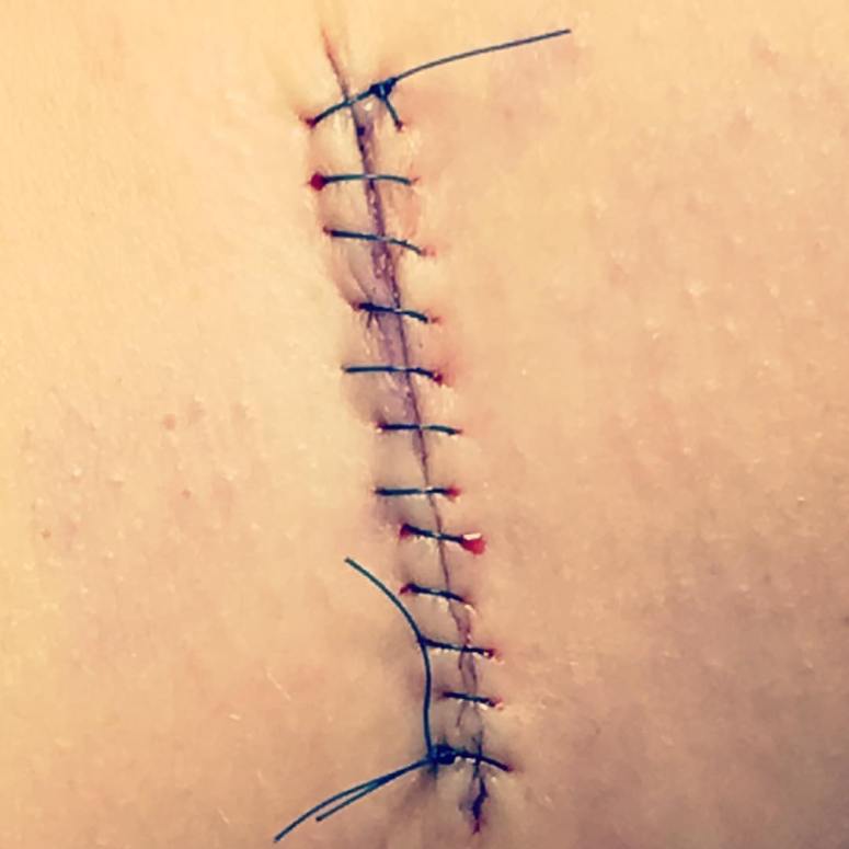 17620304_10203237551895066_2786303529937467652_o